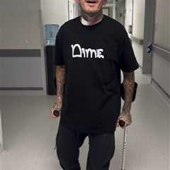 Woffy's Wild Ride: From Coma to Crutches in 3 Weeks (And Still Cracking Jokes)
